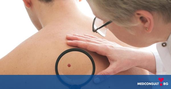 Все повече хора страдат от рак на кожата