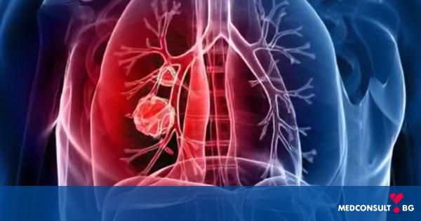 Възпаление на белите дробове: симптоми, лечение на пневмония при възрастни