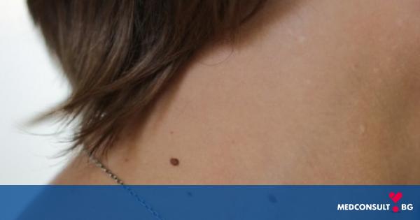 Разликата между рак на кожата и меланом: как да ги разпознаем